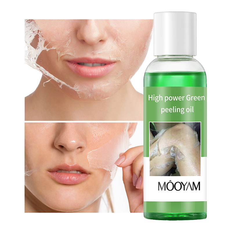 น้ำมันผลัดเซลล์ผิวแบบลอกออกด้ว - Skincare Salicylic Acid บทวิจารณ์และราคา