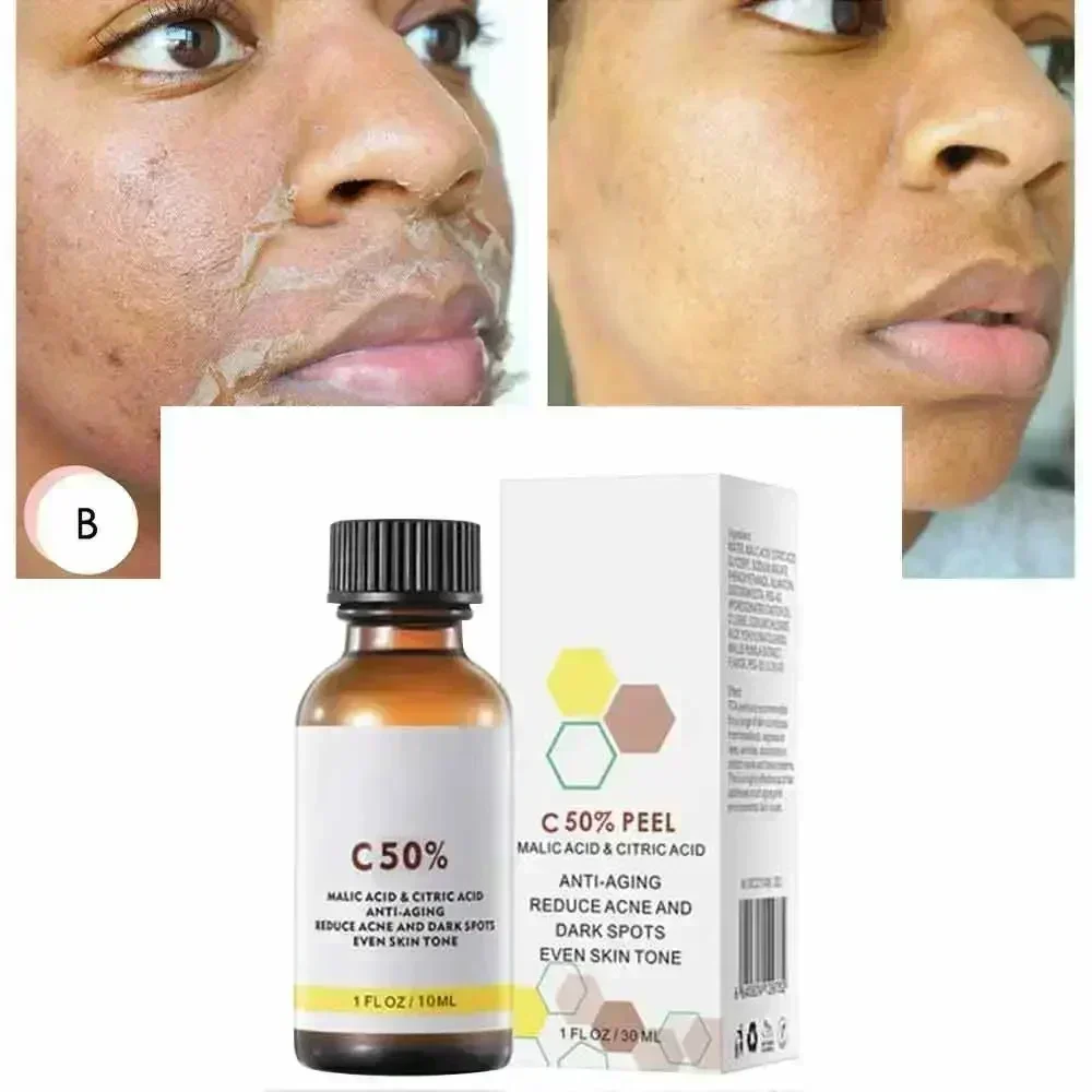 Salicylic Acid Face Facial Pee - Skincare Salicylic Acid บทวิจารณ์และราคา