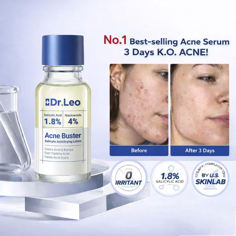โลชั่นบำรุงผิวหน้าด้วยสารสกัดจ - Skincare Salicylic Acid บทวิจารณ์และราคา