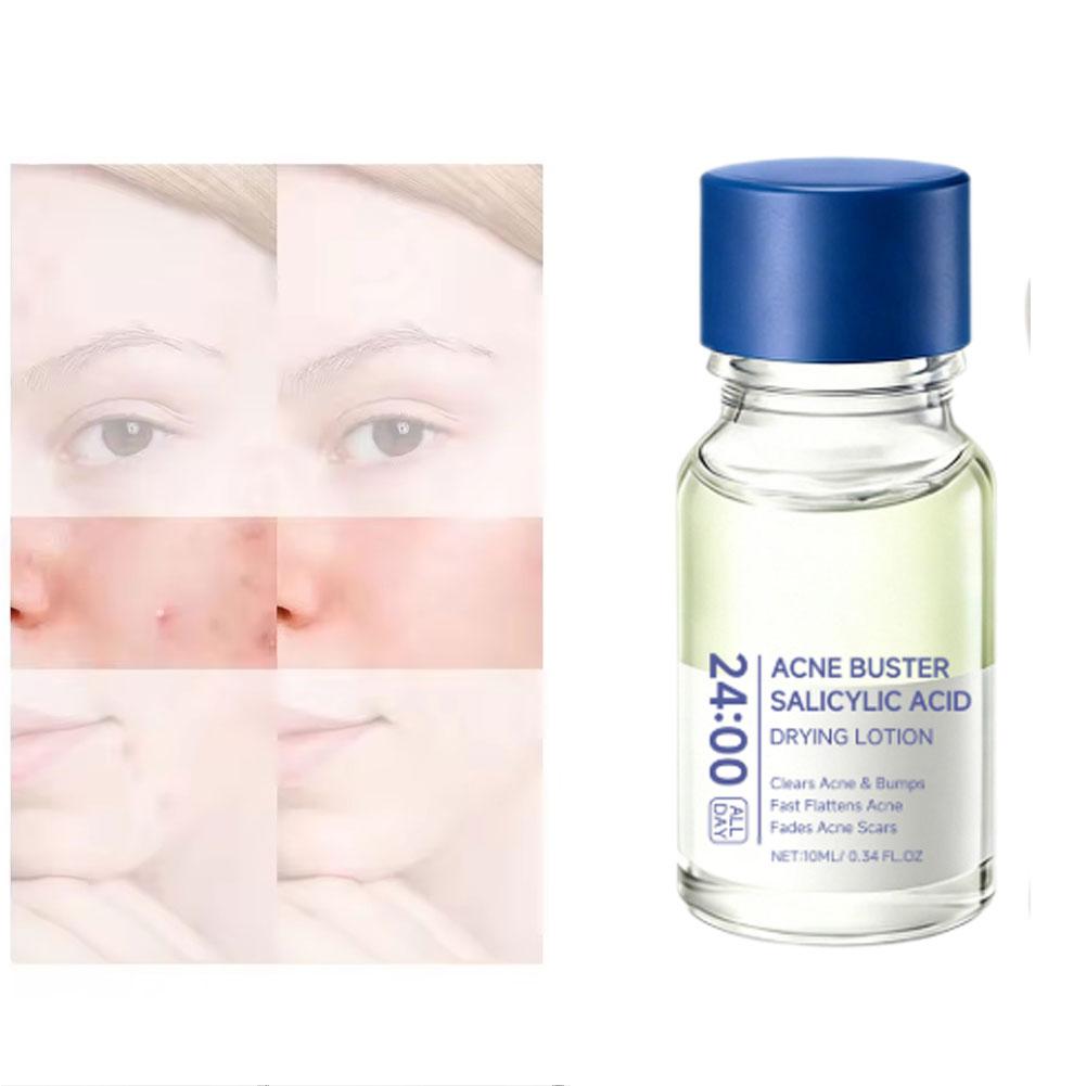 ซาลิไซลิก แอซิด เอสเซ้นส์ ทรีท - Skincare Salicylic Acid บทวิจารณ์และราคา
