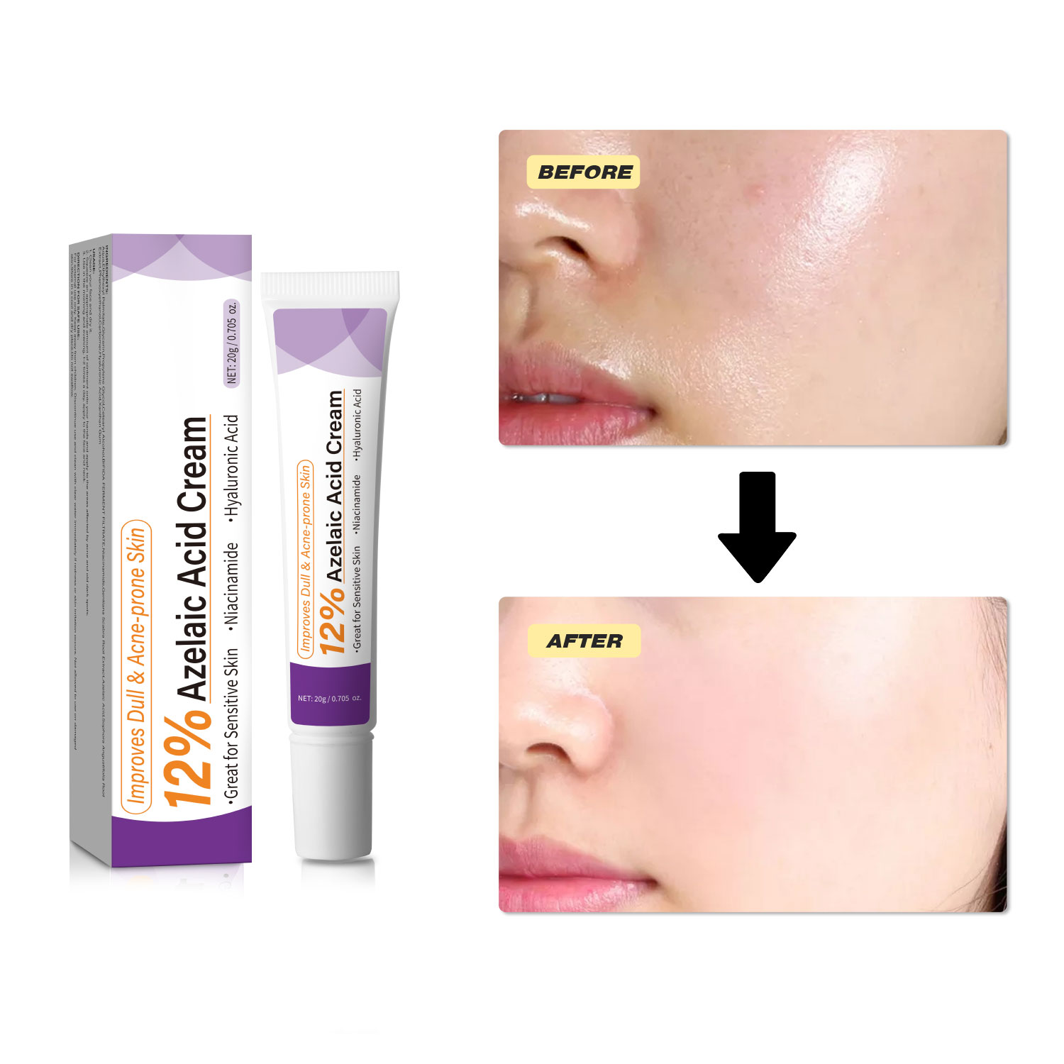 ครีมกรดอะซีเลอิกสูตรอ่อนโยน ช่ - Skincare Skintific บทวิจารณ์และราคา