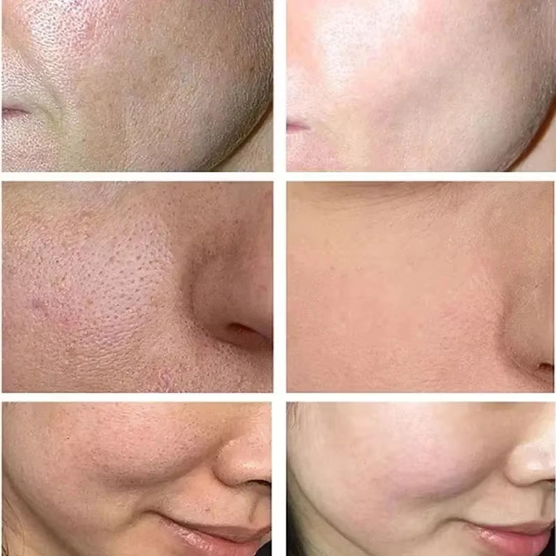 ครีมกระชับรูขุมขนด้วยกรดซาลิไซ - Skincare Salicylic Acid บทวิจารณ์และราคา