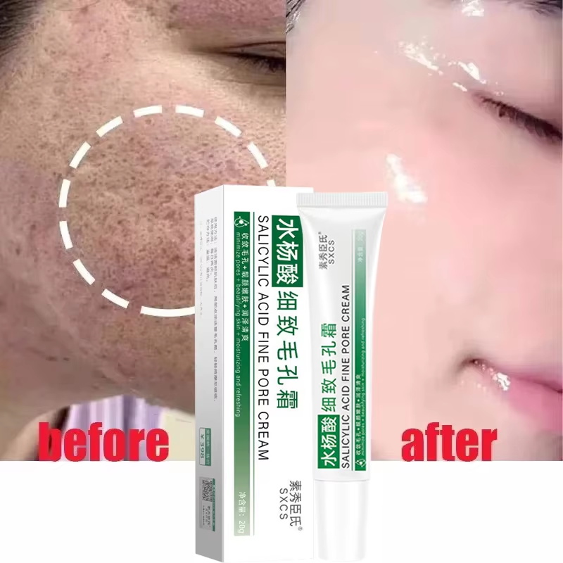 ครีมกระชับรูขุมขนด้วยกรดซาลิไซ - Skincare Salicylic Acid บทวิจารณ์และราคา