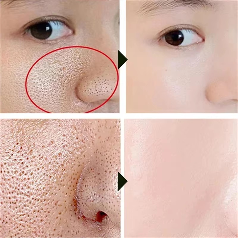 ครีมกระชับรูขุมขนด้วยกรดซาลิไซ - Skincare Salicylic Acid บทวิจารณ์และราคา